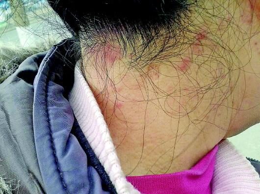 点击进入下一页