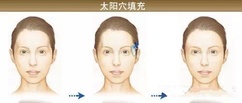 279-150202160K4T0 279-150202160K4T0