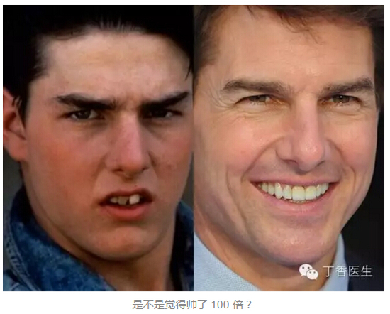 明星变美都说是因为矫正了牙齿可能吗？