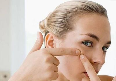 9类人别用避孕药祛痘