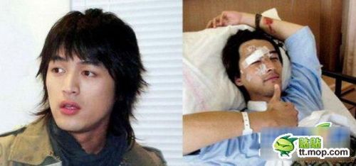田亮车祸生死不明 盘点曾出车祸的大牌明星 亲贝网