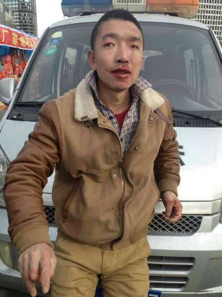 被打的黄衣男子。视频截图