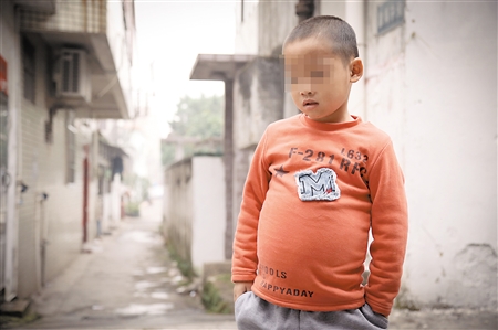 戈谢病患者小渝记者 李化 摄