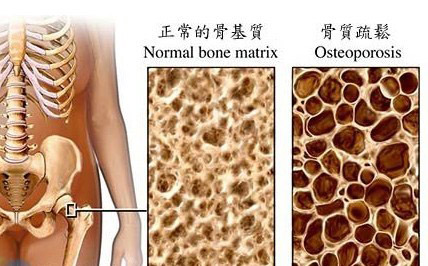 MAIN201604061105000179137246631 MAIN201604061105000179137246631