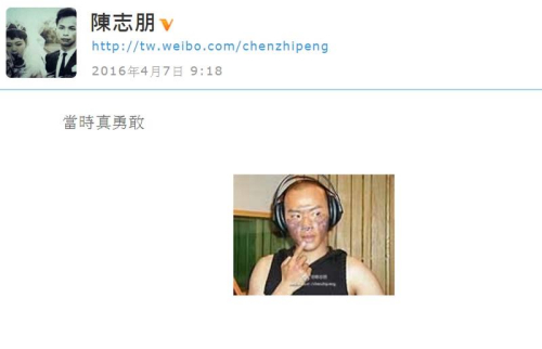 陈志朋晒脸部严重烧伤旧照自称当时真勇敢(图)