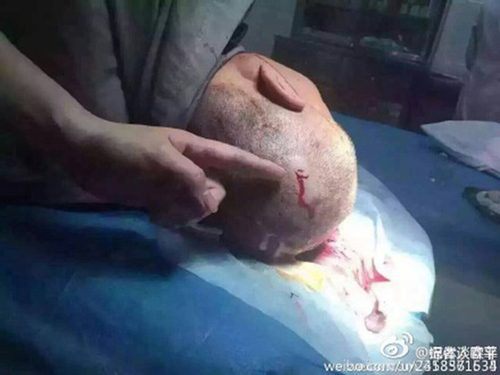 被打保安在医院接受治疗