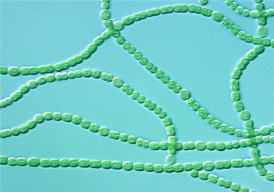 b841111706d07be1edf4c8c673100ae8 b841111706d07be1edf4c8c673100ae8