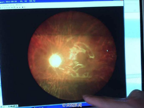 江苏26名患者被注射问题医疗气体 致12人单眼盲