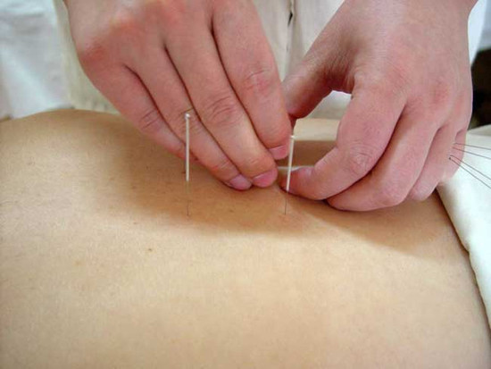 针灸时如果发生晕针怎么办?