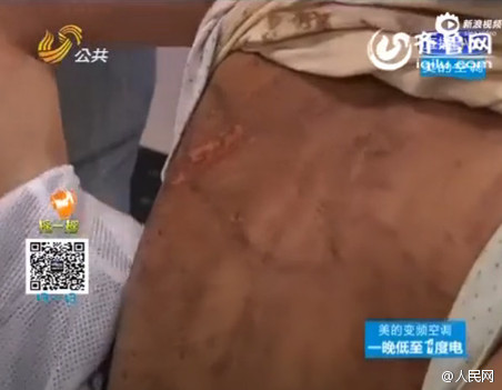 9岁女孩疑遭家暴遍体鳞伤 