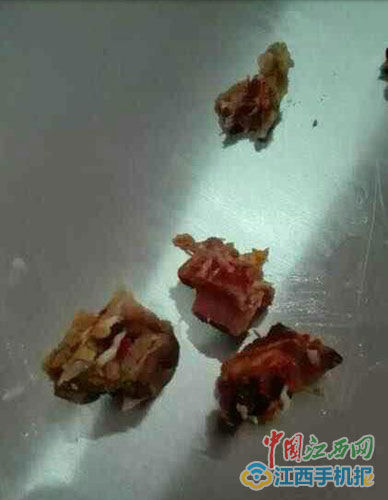 江西一学校食堂现长蛆鸭肉 校方致歉采购员撤职