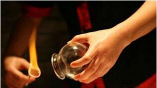 夏天拔罐效果最好 祛湿又能除顽疾！