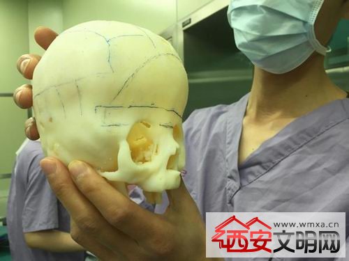 手术过程如同拼图