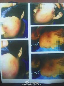 女老师连扇小学生10多个耳光 遭家长殴打(图)