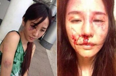 合肥女律师遭家暴 究竟有何深仇大恨挑断妻子手筋脚筋？(组图)