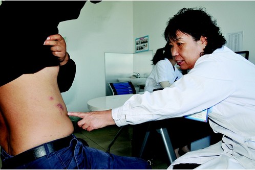 为什么年轻人也会得“带状疱疹”？