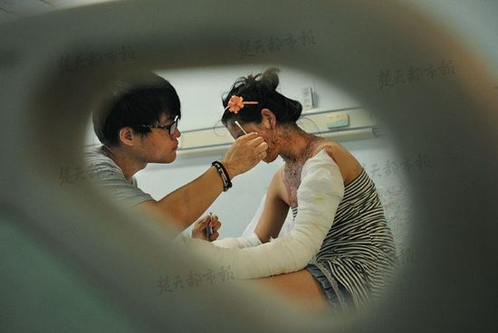 21岁女大学生自幼丧母 遭患精神病弟弟开水淋头