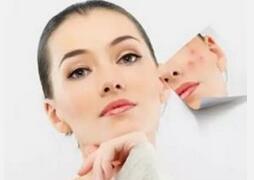 日晒出红斑当心过敏 夏季也需严防过敏