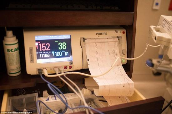 只有在做各种检查的时候，罗宾逊才能够拍些照片。这是她和丈夫的第二个孩子，他们的大儿子今年已经九岁了。为了生第二个宝宝，他们花费了很多精力，还曾经经受过了两次流产，夫妇二人一度想放弃。