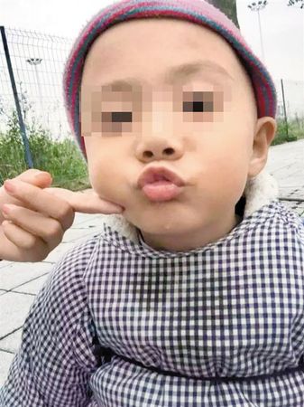 自闭儿尸检结果 自闭儿尸检结果