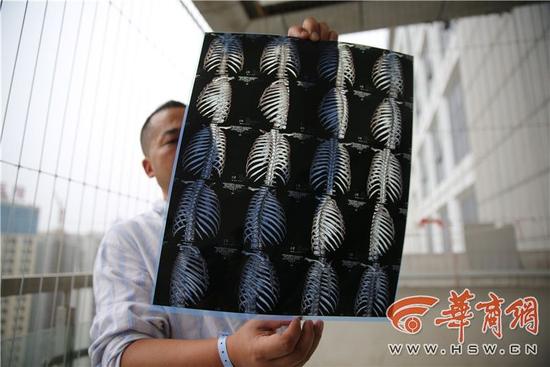 z823446d.jpg 陕西一业主埋怨轿车堵门 被车主打断肋骨