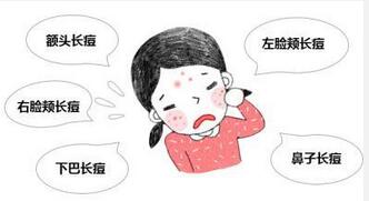 只留青春不留痘 全靠日常肌肤护理7步曲