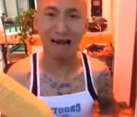 男子表示从来没想到会是这个结果的，看到自己上下门牙掉光后几乎处于崩溃边缘。