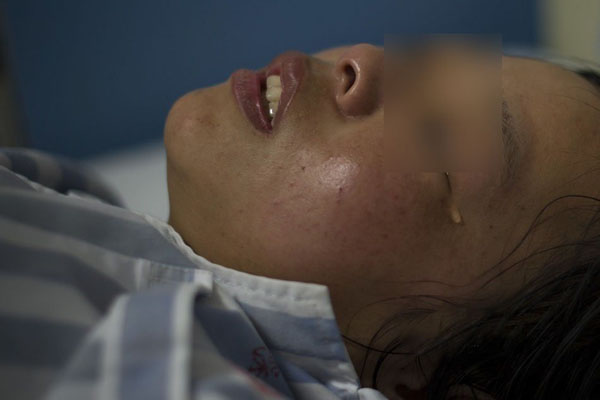 女孩被母亲男友砍伤 身中10多刀两条手筋被砍断2 女孩被母亲男友砍伤 身中10多刀两条手筋被砍断2