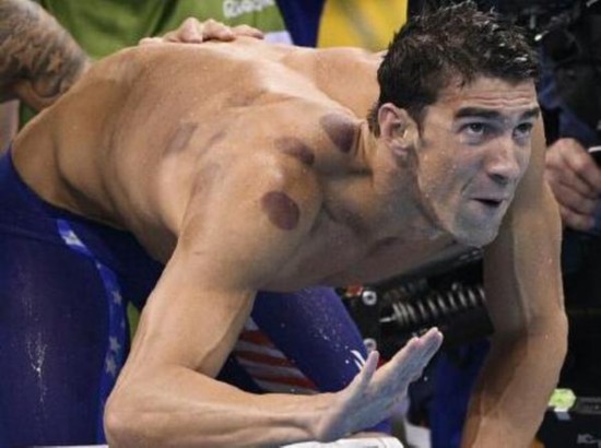 15514647828309705736 15514647828309705736