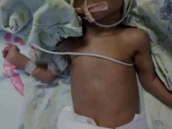 夫妻生下非洲宝宝 夫妻生下非洲宝宝