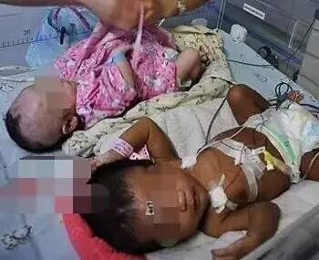 夫妻生下非洲宝宝3 夫妻生下非洲宝宝3