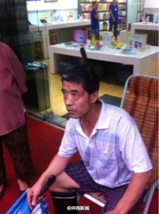 天降飞刀插入头顶 盘点大难不死的强人们