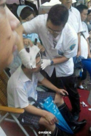 天降飞刀插入头顶 盘点大难不死的强人们