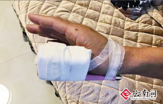 网曝老师帮女儿发小广告被小区保安群殴手指骨折物管:是他自己摔倒