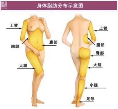 脂肪分布示意图