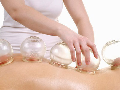 中医拔罐 中医拔罐