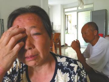 薛英右眼失去了视力，全家一筹莫展。