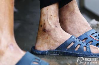 家人给老人脚上栓铁链 家人给老人脚上栓铁链