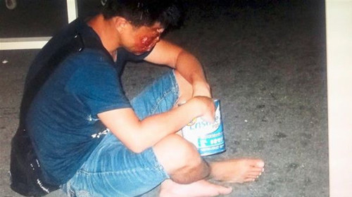 马来西亚《星报》10月17日揭露跨国犯罪团伙在中国拐骗儿童的消息称，犯罪团伙将拐来的儿童弄残、毁容并囚禁多年，再带到马来西亚各景点行乞。据报道，犯罪团伙让行乞者持旅游签证入境马来西亚，到各个旅游景点行乞，并将大部分“收入”上缴团伙头目。