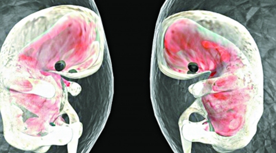 MAIN201610191101071893224294023 MAIN201610191101071893224294023