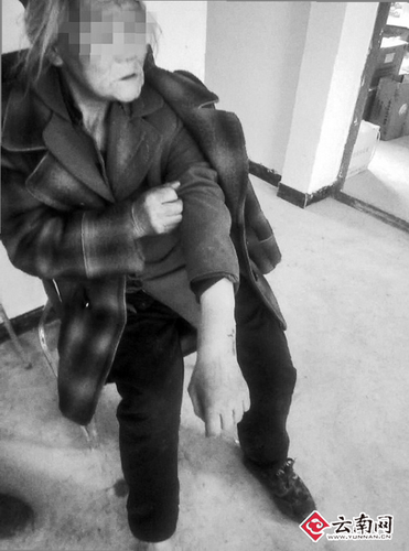 六旬大妈遭野猪袭击全身多处受伤 野猪频肇事咋破解