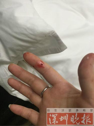 女子入住深圳一酒店 半夜醒来床上惊现十几只臭虫