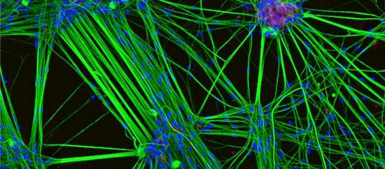 本次大赛获奖作品还包括65颗浮游动物化石、人类皮肤神经元、龙虱前足、蜈蚣的尖牙、碘酸融化的气泡等。