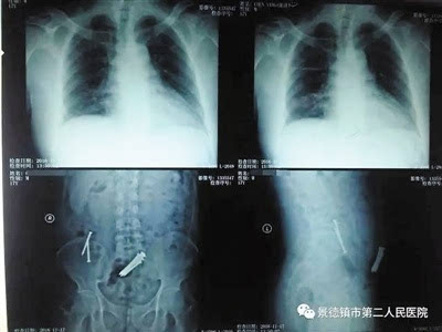 148227387272564399 148227387272564399