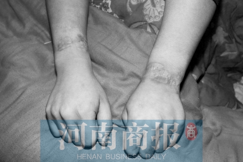 男孩精神分裂被锁小屋447天 母亲:打伤别人谁抵命