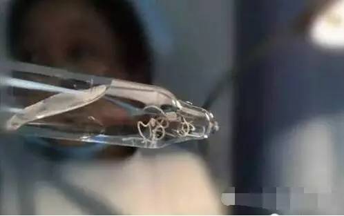 老人眼睛长出虫子 老人眼睛长出虫子