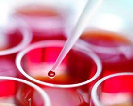 u=1852403827,2632123211&fm=21&gp=0 u=1852403827,2632123211&fm=21&gp=0