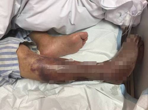 W020170204314101427459 W020170204314101427459