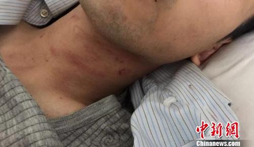 被打中国游客忆越南囧途：母亲被逼看儿子被打