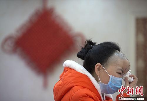 女子拒绝复婚被前夫咬掉鼻子 取肋软骨重造鼻